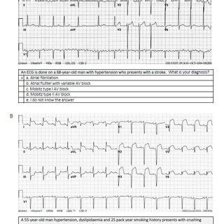 validity of ecg result|Clinically contextualised ECG interpretation: the impact .